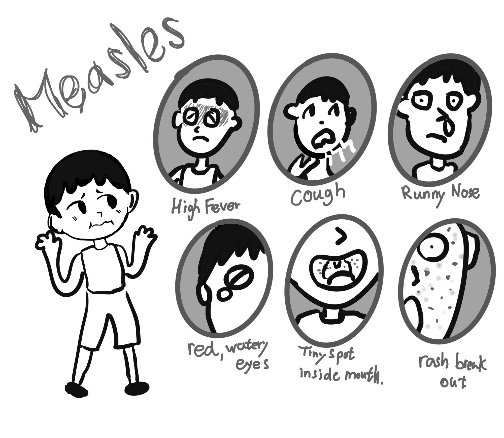 Measles symptoms appear as a cold or flu, tiny spots inside the month and rashes breaks out over the body.